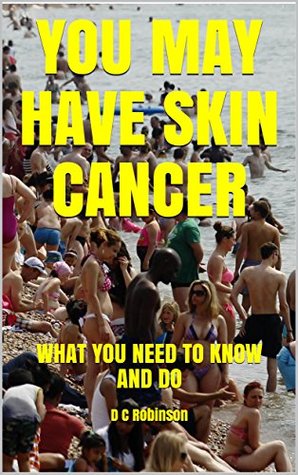 Full Download You May Have Skin Cancer: What You Need to Know and Do - D.C. Robinson | PDF